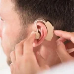 Amplificador auditivo para pérdida leve o moderada
